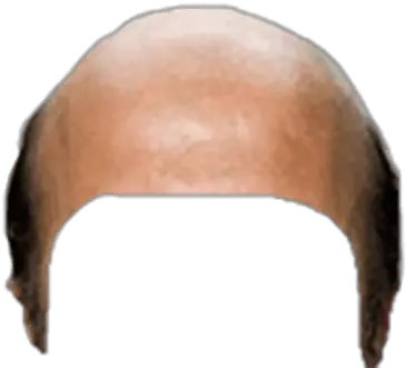 Bald Head Snapchat Filter Transparent Bald Head Transparent Png Bald Head Png