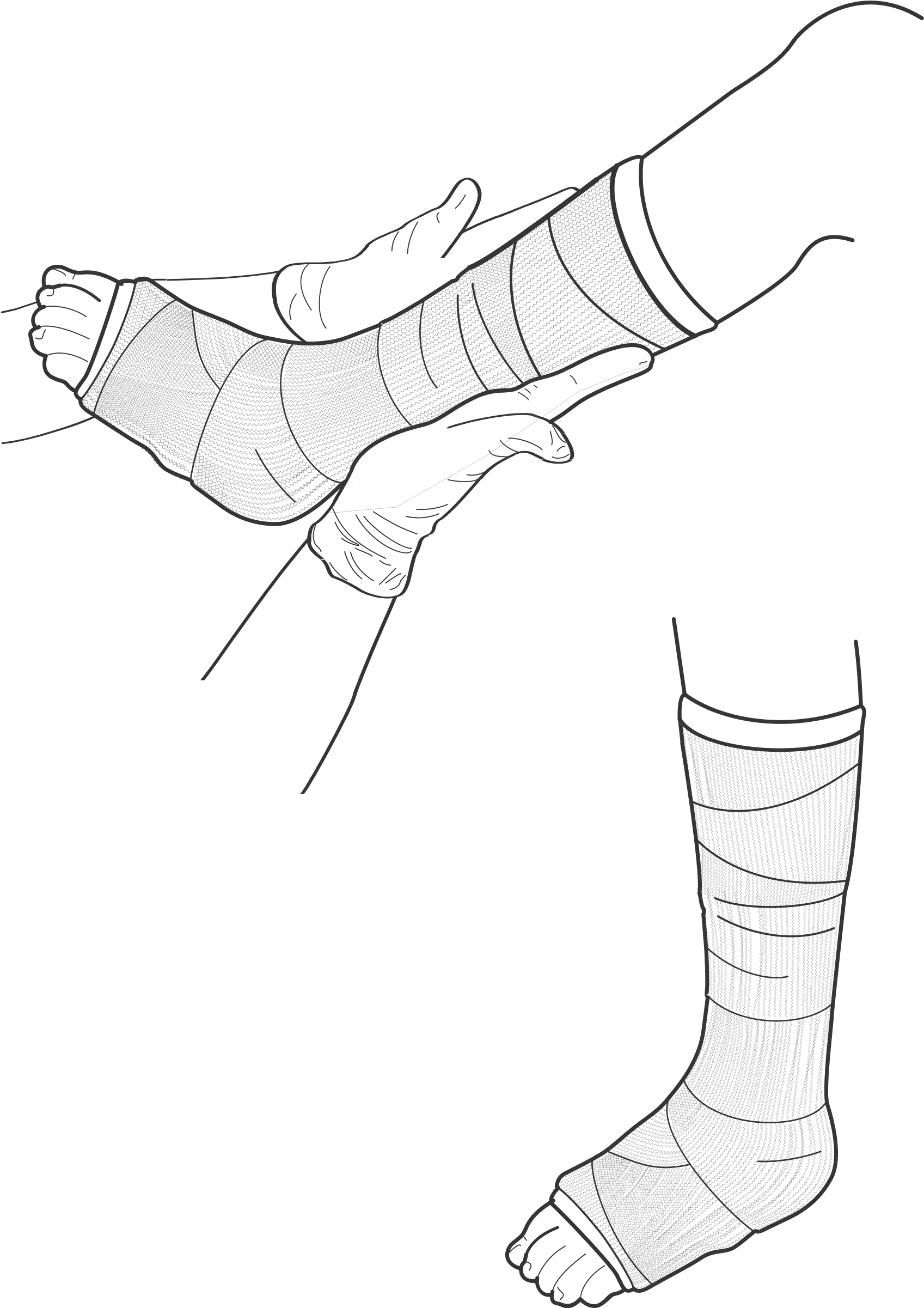 Broken Leg Drawing Drawing Of Broken Leg Png Leg Transparent