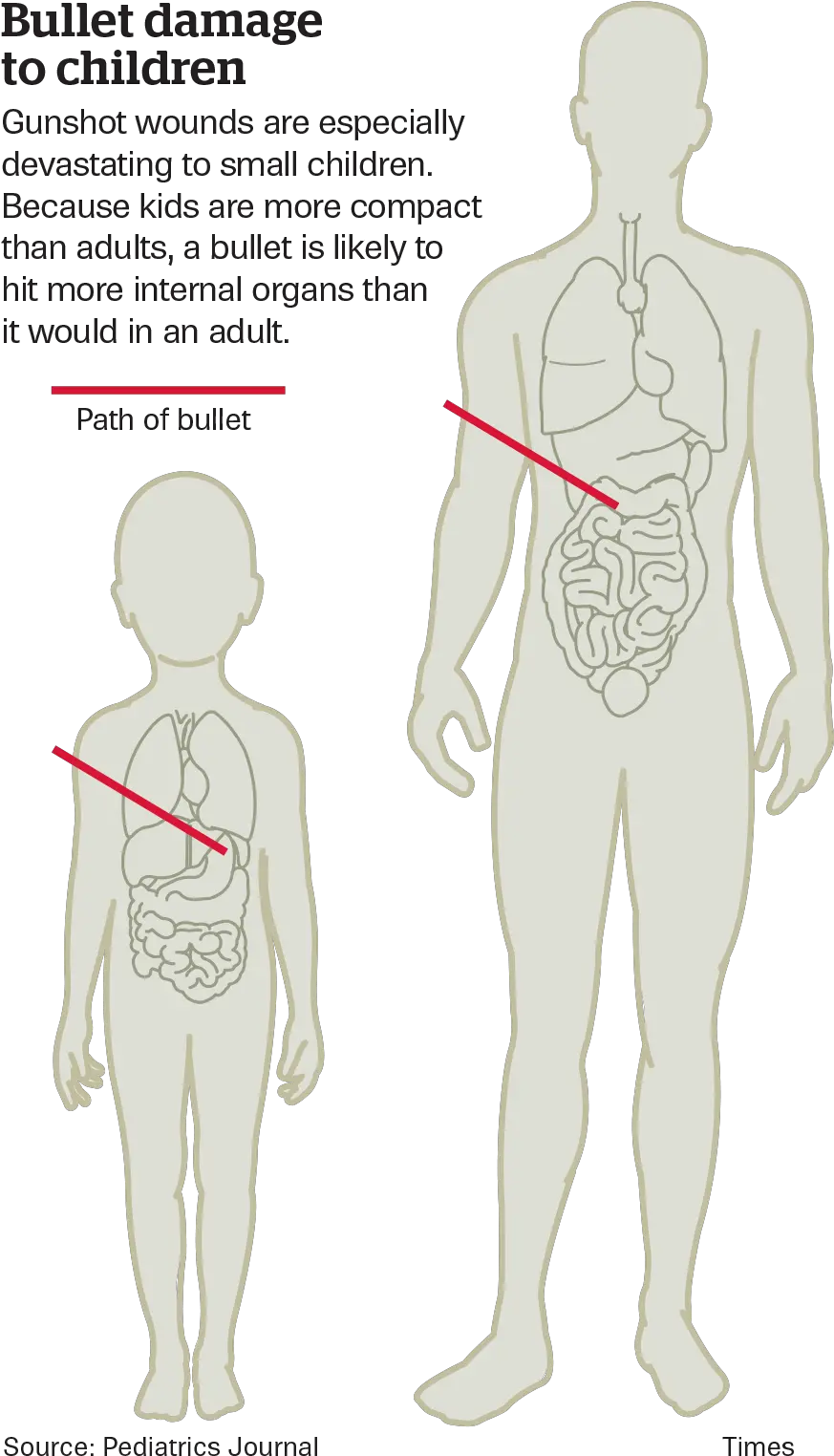 Hip Png Images Gunshot Wound Bullet Wound Scar Joint Png
