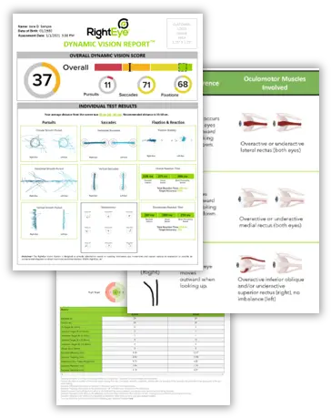 Righteye Vision System Eye Tracking Technology Software Png Eye Tracking Icon