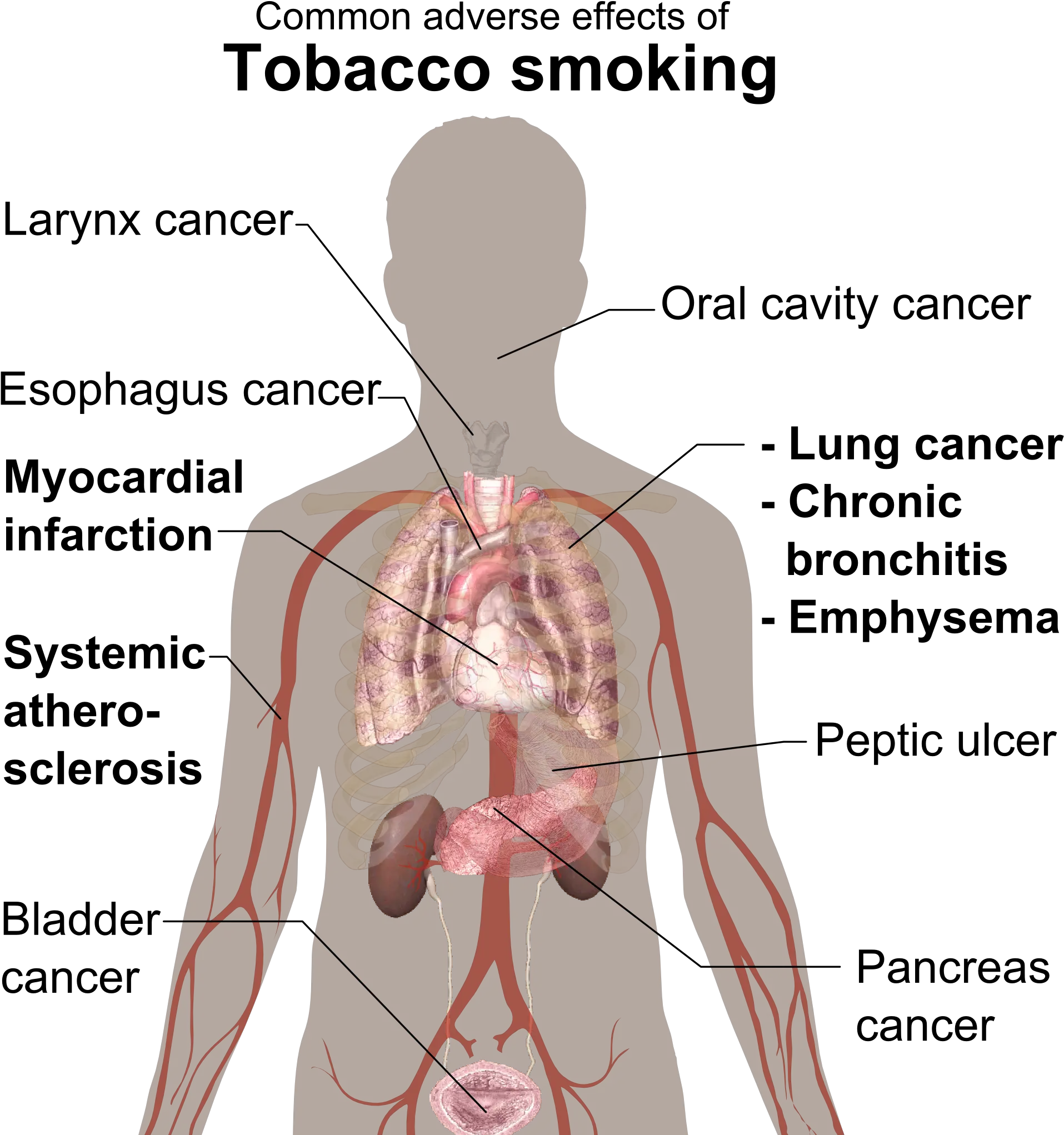 Fileadverse Effects Of Tobacco Smokingpng Wikimedia Commons Physical Effects Of Smoking Effects Png