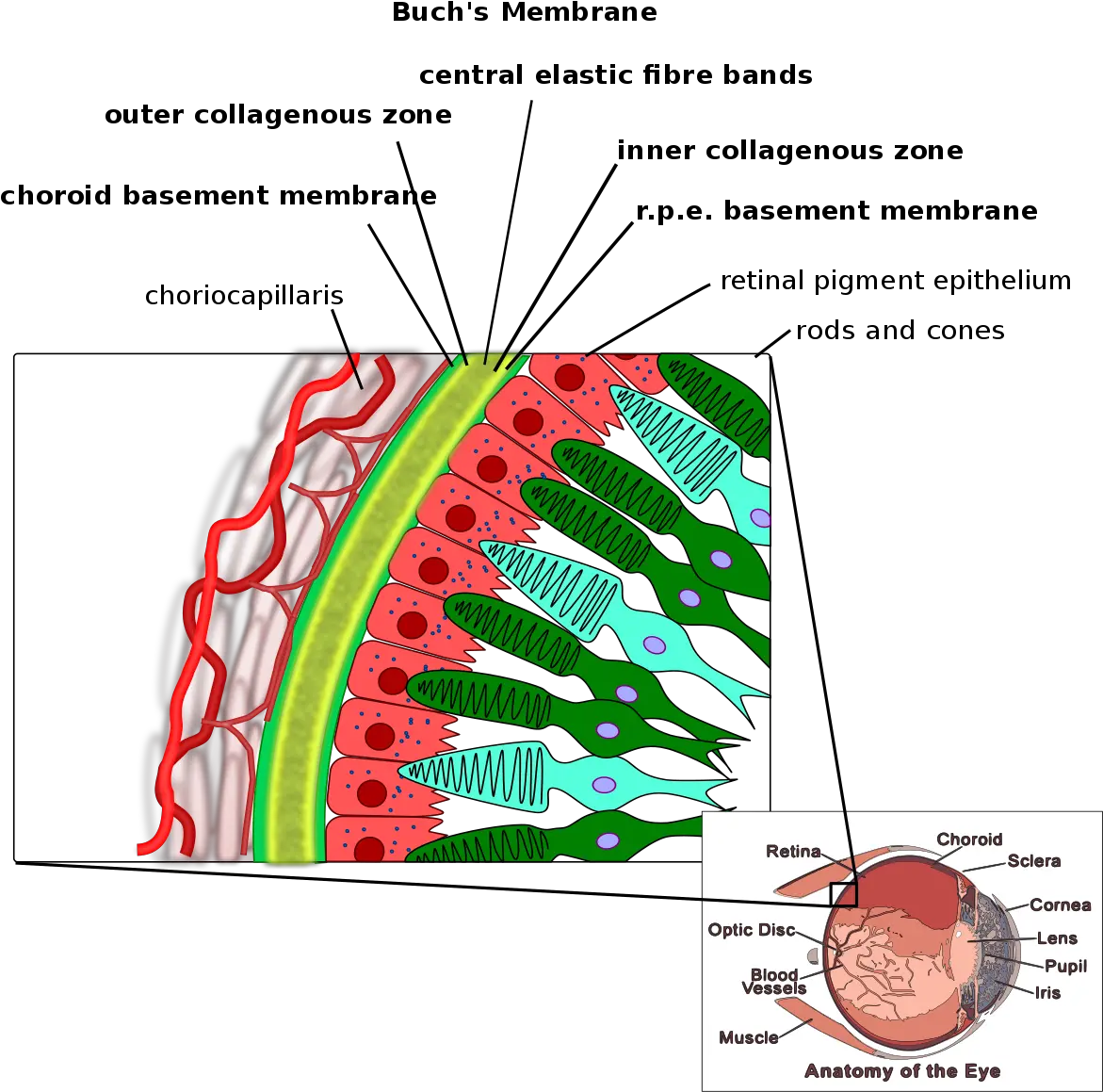 Angioid Streaks Layers Of Membrane Png Streaks Png