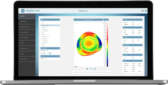 Eye Surface Profiler The Ultimate In Ocular Topography Eaglet Eye Surface Profiler Png Eye Icon On Computer