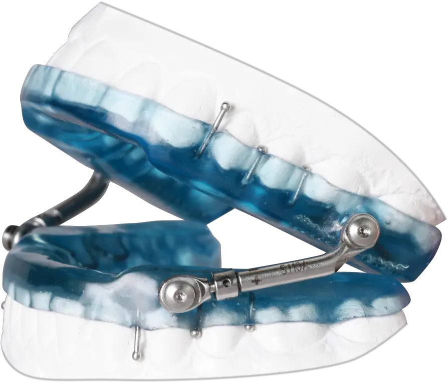 Oral Appliance Therapy Sleep Scholar Oral Appliance Png Apnea Icon Cpap