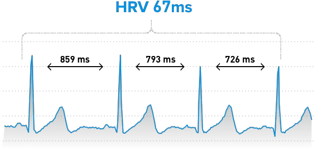 Heart Rate Variability The Ultimate Guide To Hrv Whoop Heart Rate Variability Png Heart Beat Png