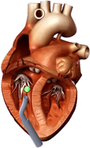 Fileheartpng Paul Thienphrapa 3d Heart Model Orange Heart Png