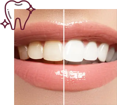 Teeth Whitening Holland Cross Dental Teeth Whitening Png Smile Teeth Png
