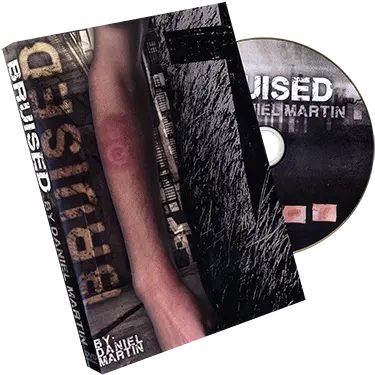 Bruised By Daniel Martin Trick Wallet Png Bruise Png