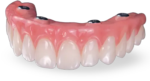 Why Is My Palateless Denture Loose Hybrid Denture Implants Png Jawbone Icon Earhook