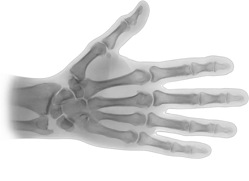 Download Hd X Ray Transparent Png X Ray Hand Png X Ray Png