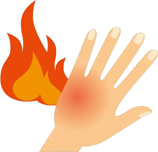 Skin Clipart Burned Food Burn Clipart Png Burn Png