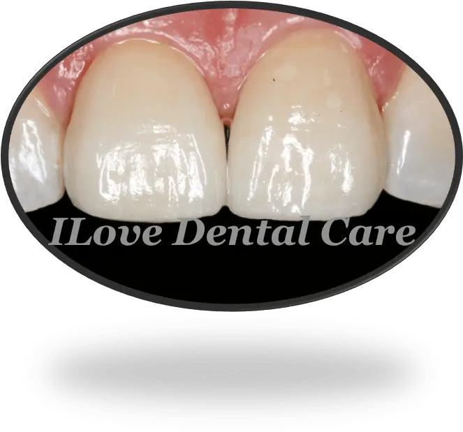 Cosmetic Dentistry U2013 Ilove Dental Care Ugly Png Cosmetic Dentistry Icon
