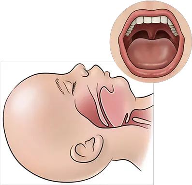 Pediatirc Tracheostomy Handbook Patient And Family Ugly Png Charger For Jawbone Icon