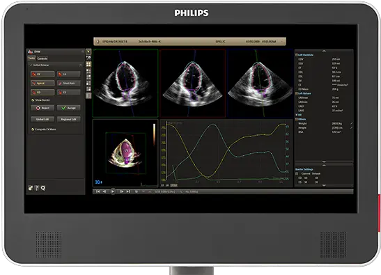 Heartmodel 3d Echocardiography Philips Healthcare Philips Heart Model Png 3d Heart Png