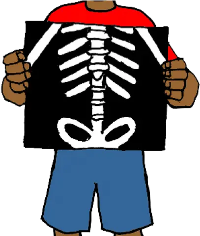 X Ray Clipart Png Transparent Clipart Of X Ray X Ray Png