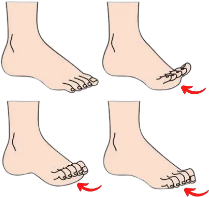 Claw Toe Curled Under Digits Next Step Foot U0026 Ankle Clinic Do My Toes Curl Down Png Toe 2 Icon