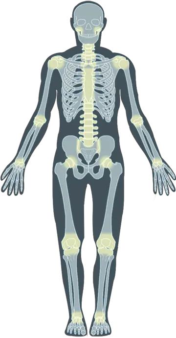 Wwwsharmaorthocom Imagesskelhoverimages Orthopaedic Implants Png Body Png