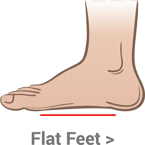 Flat Feet U2013 Kassis Brothers Shoes Cat Grabs Treat Png Feet Png