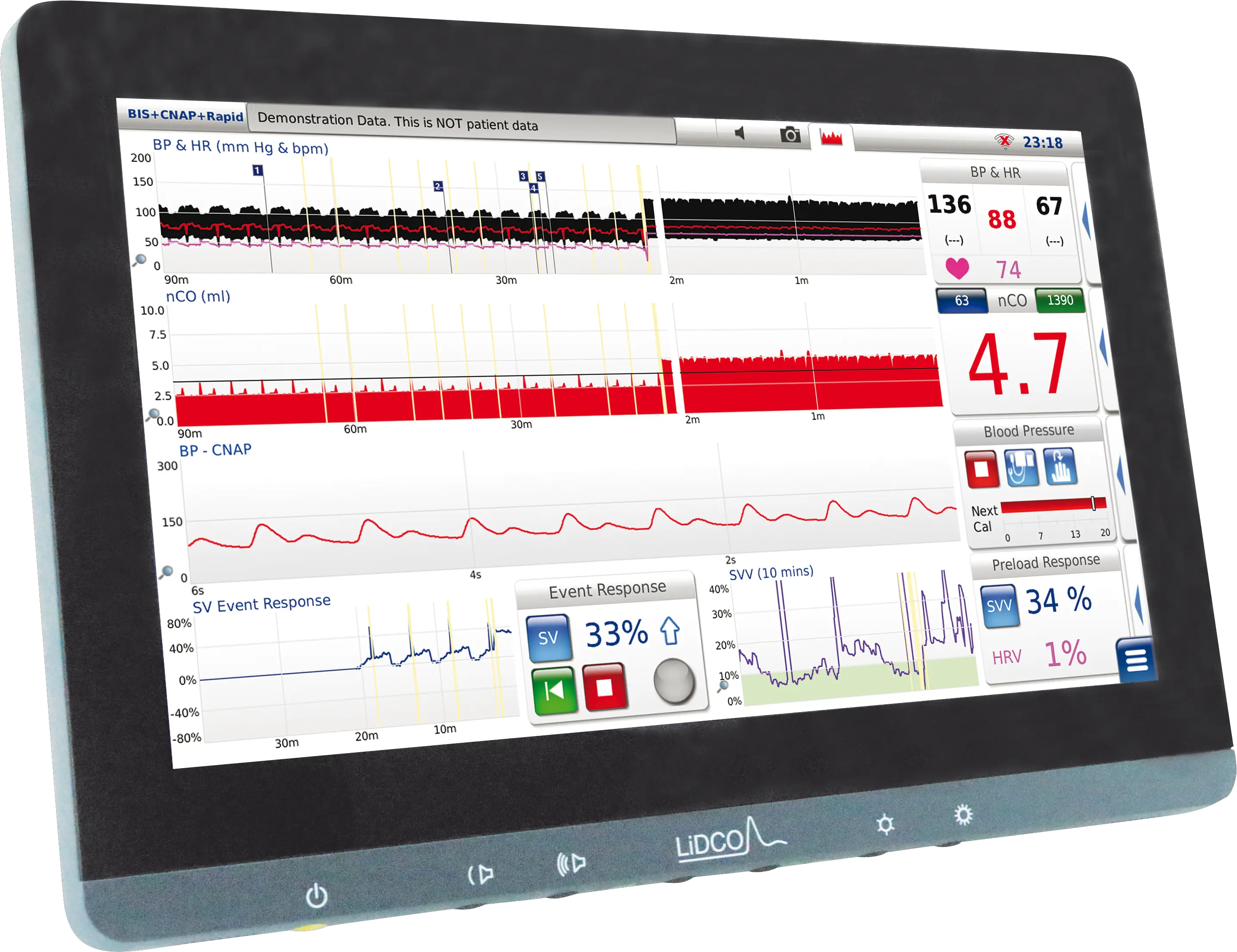 New Monitor Transparent Background Lidco U2013 Hemodynamic Lidco Hemodynamic Monitoring Png Linkedin Logo Png Transparent Background