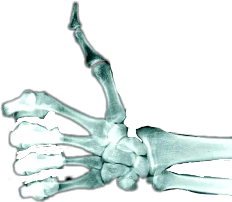 Download Skeleton Hand Thumbs Up Thumbs Up Skeleton Hand Png Skeleton Hand Png