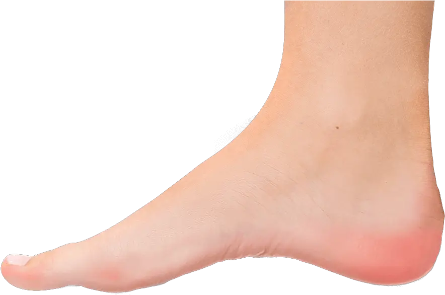 Austin Plantar Fasciitis Transparent Foot Png Toe Png