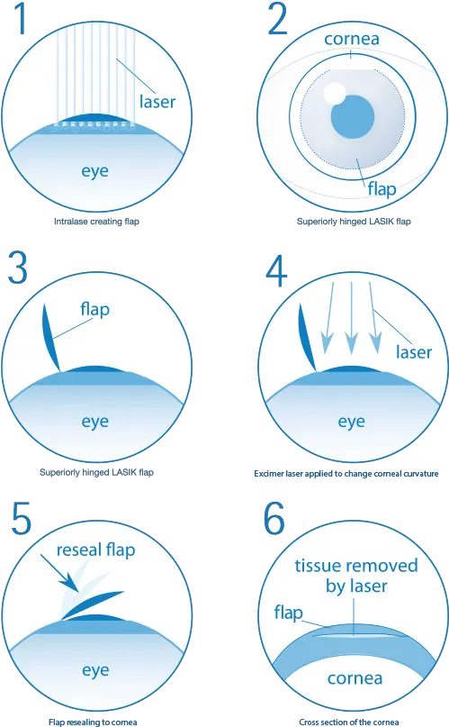 Lasik Circle Png Laser Eye Png