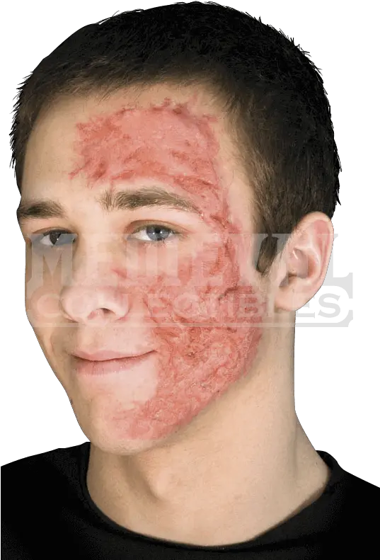 Hd Burn Scar Face Free Unlimited Downl 628958 Png Burn Scars Png Burn Png