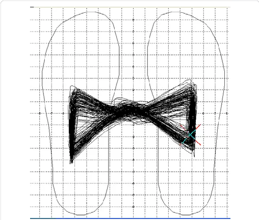 Cyclogram The U0027center Of Gravityu0027 Of The Forces Displayed Cyclogram Png Feet Transparent