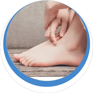 Foot With Sand First Stage Stage 1 Early Rheumatoid Arthritis Png Feet Png