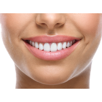 White Teeth Image