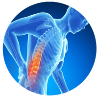Back Pain Picture Free Photo PNG