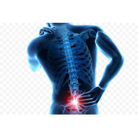 Back Pain HQ Image Free PNG