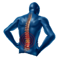 Back Pain Free Download PNG HQ